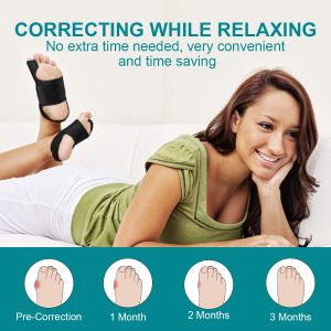 AVIDDA Bunion Corrector Set – Adjustable Splints & Gel Toe Separators, Black