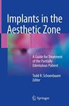 Implants in the Aesthetic Zone: A Guide for Treatment of the Partially Edentulous Patient