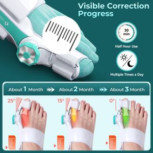 TENICORE Bunion Corrector – Adjustable Toe Straightener with Anti-Slip Heel Strap, Day & Night Support, 1PC