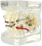 Orthodontic Demonstration Model with Stainless Steel Brackets and Colorful Ligatures - Misaligned Teeth Correction Display on Transparent Acrylic Base - Ideal for Educational and Training Purposes