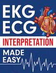 EKG | ECG Interpretation Made Easy: An Illustrated Study Guide For Students To Easily Learn How To Read & Interpret ECG Strips