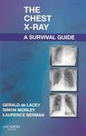 The Chest X-Ray: A Survival Guide