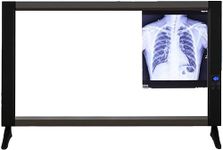 Radiology Illuminators