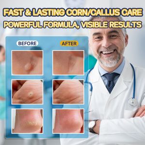 Extra Strength Corn Remover Liquid, 20ml – Fast Callus Treatment