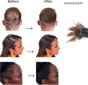 Nanogen Hair Fibres Dark Brown – Instant Hair Thickening Solution