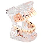 Walfront Dental Teaching Teeth Model Standard Tooth Model for Demonstration Disease Education (#3)