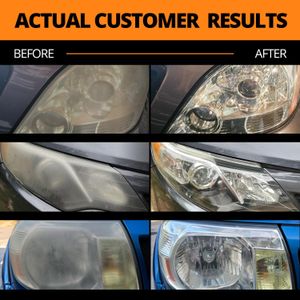 CERAKOTE Ceramic Headlight Restoration Kit – Complete Lens Cleaner