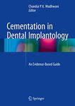 Cementation in Dental Implantology: An Evidence-Based Guide