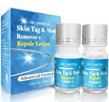Skin Tag Remover, Skin Tag Removal Kit, Extra Strength Skin Tag Remover and Repair Lotion