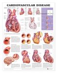 Cardiovascular Disease Chart: (Laminated)