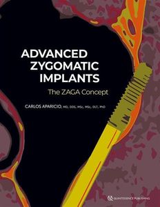 Advanced Zygomatic Implants: The Zaga Concept