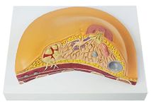 ZX | Breast Pathologies Model | Anatomical Model