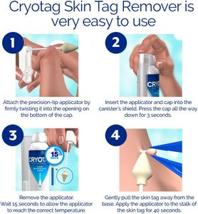 Cryotag Skin Tag Remover – Easy At-Home Skin Tag Removal