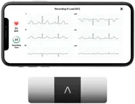 KardiaMobile 6-Lead Personal EKG Mo