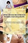 HOW TO CLEAR STRETCH MARKS AND CELLULITE: A Comprehensive Guide to Clearing Stretch Marks and Cellulite with Homemade Remedies