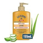 Gold Bond Anti-Itch Lotion - 155ml Bottle - Relieves Itching Associated With Minor Burns, Cuts, Rashes, and Scrapes - Aloe, Vitamin E, and B5 - for Tough, Dry, and Itchy Skin - Use on Hands and Body