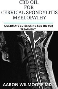 CBD Oil for CERVICAL SPONDYLITIS MYELOPATHY: All You Need To Know About How CBD OIL WORKS for CERVICAL SPONDYLITIS MYELOPATHY