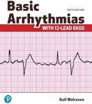 Basic Arrhythmias With 12-Lead EKGs