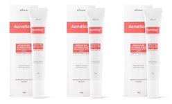 Brinton AcneScar Advanced Gel for Acne Scars & Acne Pits| Help to Reduce Old & New Scar| Reduces Pigmentation| Fights Acne & Blackheads | Suitable for All Skin Types for Men & Women 15g x Pack of 3