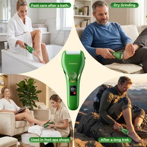 Electric Foot File Callus Remover – Rechargeable Pedicure Tool