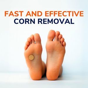 Scholl Corn Removal Kit – Fast-Acting Relief for Corns and Calluses