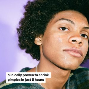 Starface Hydro-Star Clear Pimple Patches – Acne Spot Treatment