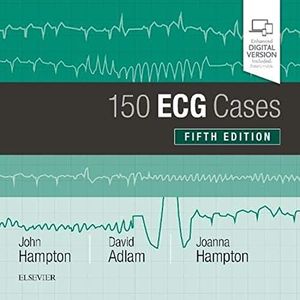 150 ECG Ca