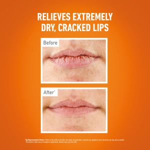 O'Keeffe's Lip Repair Balm – Unscented Moisturizing Care