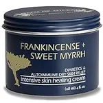 Foot Healing Cream – Frankincense and Sweet Myrrh Moisturizer for Sensitive Skin, Foot Therapy, Diabetic Skin Healing - Synergistic Action, Deeply Nourishing, Relieving by Balm of Gilead