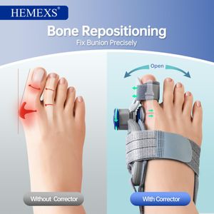 HEMEXS Bunion Corrector Splint for Women & Men – Adjustable Toe Alignment, Day & Night Relief