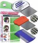 OWNHEALER Professional Lice Comb Kit - for Lice, Nits, and Dandruff Removal. Quick Results for Head Lice Treatment - Suitable for All Hair Types. Peigne à Poux Professionnel.