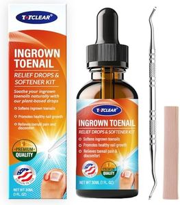 Ingrown To