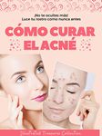 Cómo curar el acné: Valiosos métodos para prevenir y curar el acné. Evitar complicaciones más graves y puedas lucir una piel sana: ¡No te ocultes más!, ... tu rostro como nunca antes (Spanish Edition)