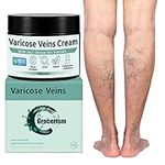 Varicose Veins Treatment for Legs -