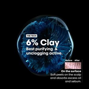 L'Oréal Scalp Advanced Clay Shampoo, 250ml – Purifying Cleanse