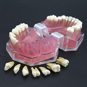Denti Mode