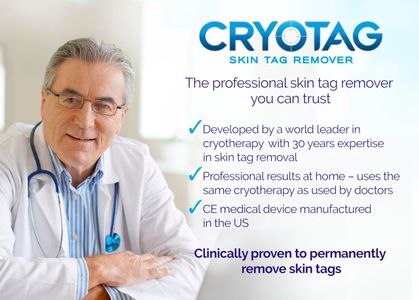Cryotag Skin Tag Remover – Easy At-Home Skin Tag Removal