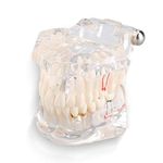PUSOKEI Dentoform Model Dentoform Teaching, Transparent Disease Teeth Model,Real Teeth Models, Dental Disease Teaching Study Adult Typodont Demonstration Teeth Model