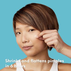SKIN CHOICE Acne Spot Patches 30-Pack – Hydrocolloid Blemish Treatment