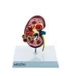 Labzio - Deluxe Human Kidney Anatomical Model, Demonstrating Normal and Diseased Kidney with Pathologies, Medical Grade Anatomical Model