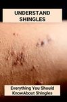 Shingles Treatments