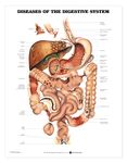 Diseases of the Digestive System Anatomical Chart