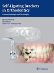 Self-Ligating Brackets in Orthodontics: Current Concepts and Techniques