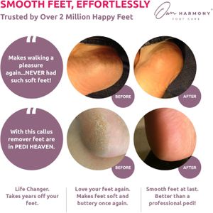 Own Harmony Electric Foot File – Rechargeable Callus Remover Pedicure Tool