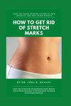 Way To Get Rid Of Stretch Marks