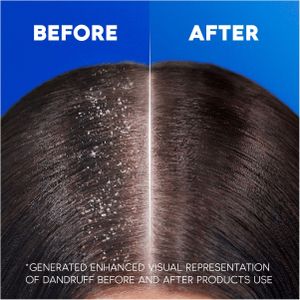 Head & Shoulders 2-in-1 Anti-Dandruff Shampoo, Classic Clean, 1000ml