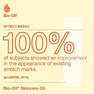 Bio Oil Body Skin Care Oil 200ml – Stretch Mark & Scar Moisturizer with Vitamin E & A