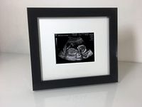 SignatureFrames 12 & 20 Week Ultrasound Sonogram Baby Scan Black Free Standing Photo Frame, Black & White