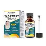 Skin Tag Removal Kit, Wart Remover, Effective Remover of Warts, Moles and Calluses, Mole & Wart Removal Liquid for Body and Hands, Suitable for All Skin Types