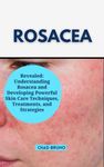 Rosacea Treatments